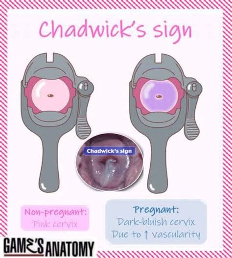 chadwicks of boston|chadwicks of boston sign in.